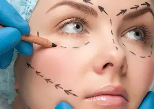 chirurgia-plastica-e-bellezza.webp