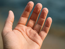 מים וקמטים - תגובה גופנית מוזרה