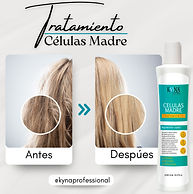 ¿Cómo detener la caÃda del cabello.jpg