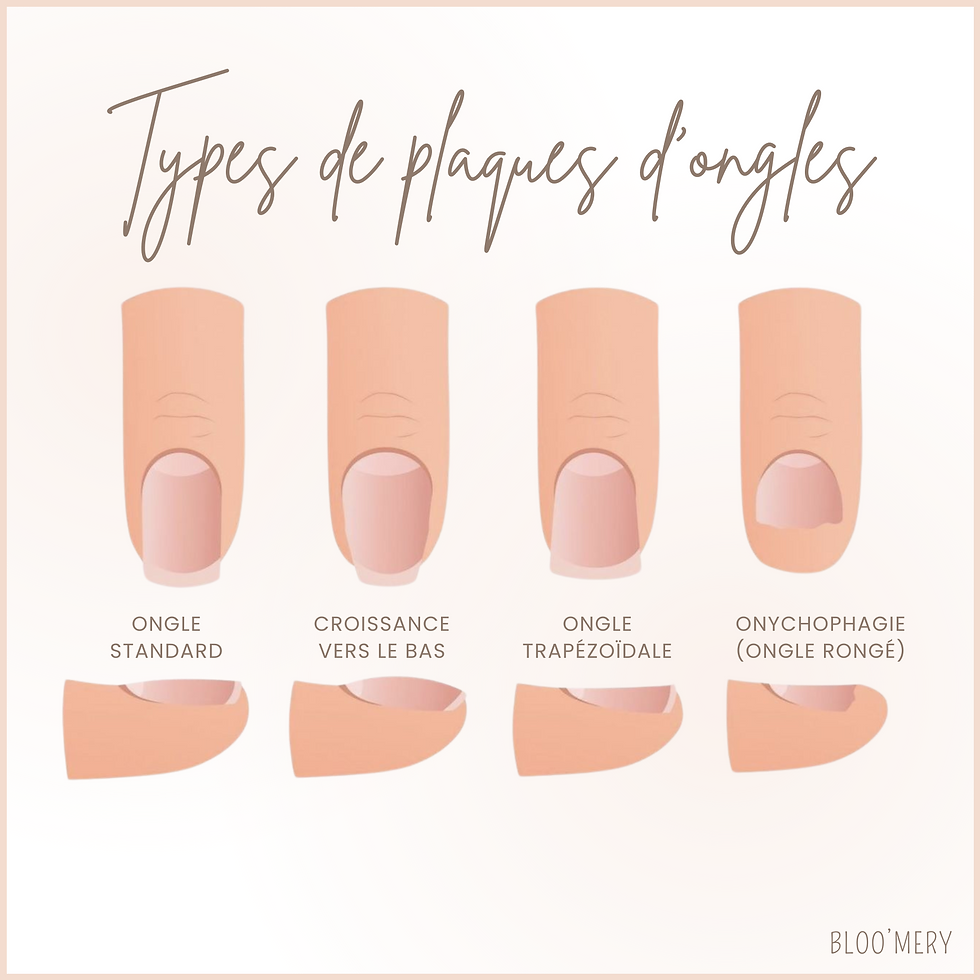 Différents types de plaques d'ongle