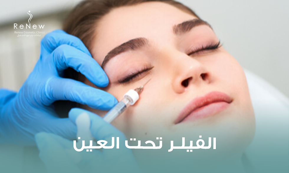 فيلر تحت العين: الفوائد والنتائج والمخاطر وهل يناسب حالتك؟