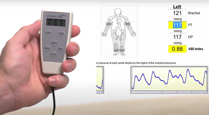 Software recording patients measurements