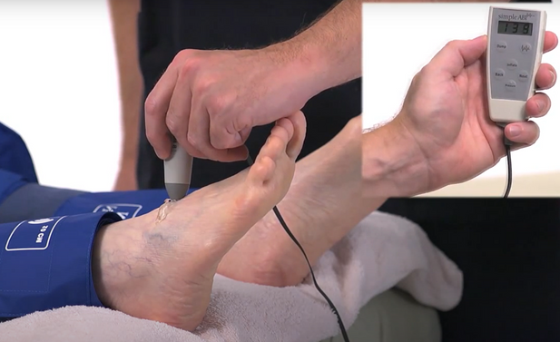 Ankle Doppler