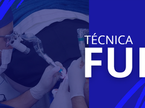 Como funciona a técnica de Transplante Capilar FUE?