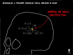 BrainScan