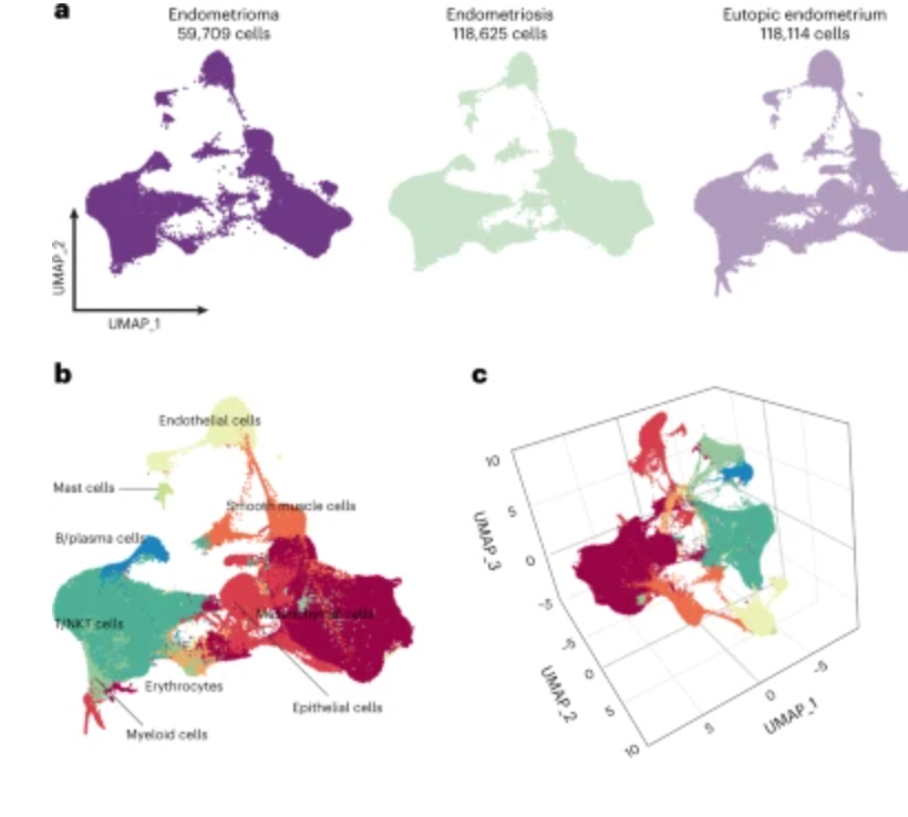 Single-cell transcriptomic analysis of endometriosis