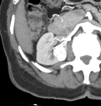 TC, vista axial, tomografía, tomography, medical images