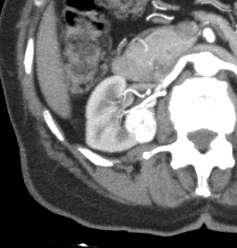TC, vista axial, tomografía, tomography, medical images