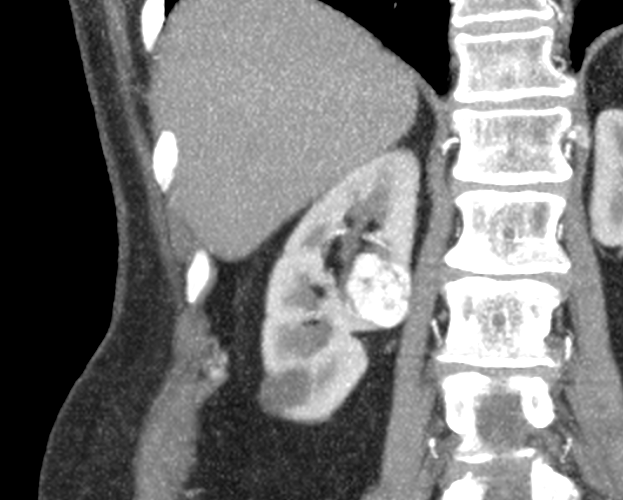 TC, vista axial, tomografía, tomography, medical images