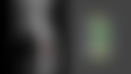 Neurocirugía: Planificación 3D virtual para tumor en columna vertebral