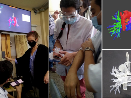 Tecnología 3D para tomar decisiones en cardiopatías congénitas complejas