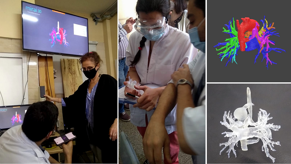 Tecnología 3D para tomar decisiones en cardiopatías congénitas complejas