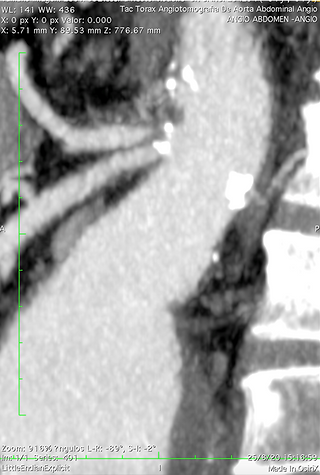 TC. Vista sagital