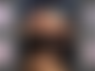 Fracturas bilaterales de tórax con tecnología 3D y técnica quirúrgica MARF