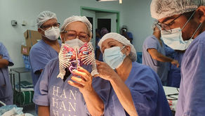 Separación de siameses toracópagos con planificación 3D