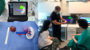 Urología 3D: Nefrectomía parcial mini-invasiva con biomodelos