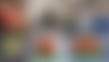 Tumores hepáticos navegados virtualmente con un modelo 3D anatómico