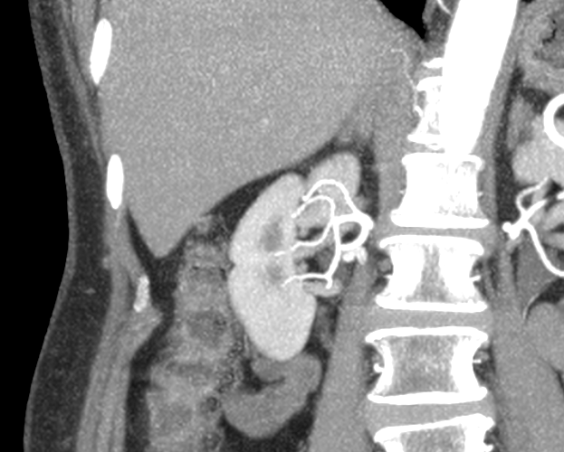 TC, vista axial, tomografía, tomography, medical images