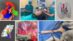 Guía para médicos: Planificación 3D y simulación en tórax