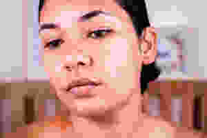 óleo de coco é comedogênico