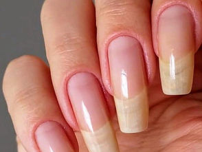 10 Dicas Essenciais de Cuidados com as Unhas