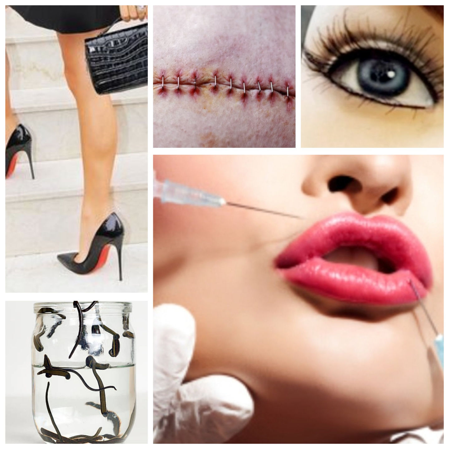 Moodboard of woman's legs in Christian Louboutin stilettos, a recent surgical incision, an eye, lips being injected with fillers, and a glass jar containing leeches in water.
