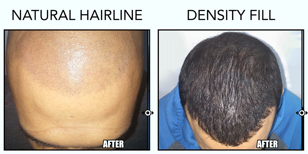 BEFORE-AFTER-GIF-1.gif