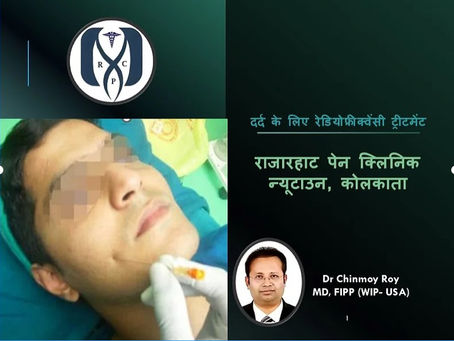 दर्द के लिए रेडियोफ्रीक्वेंसी ट्रीटमेंट