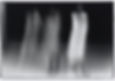 640x480 DARKENED In Front of Saint Patrick's Cathedral (69)