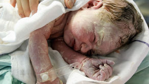 Newborn Skin