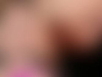 QUÉ PROVOCA LA PAPADA, CUÁLES SON LOS TIPOS DE PAPADA Y TODO LO QUE DEBES SABER