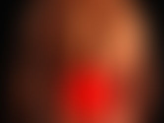 Los síntomas más comunes de piedras en el riñón