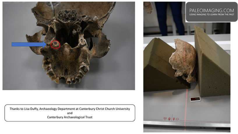 Roman skull