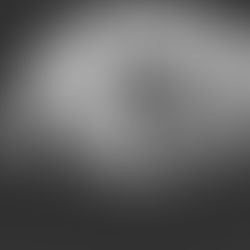 Superior/inferior x-ray of skull. The projectile can be seen just to the left of the midline.