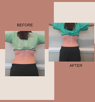GA_Lauren Papka_2 mo_Back_6-12-24.png