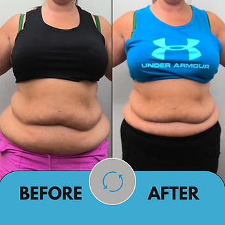 MS_Amanda McBride_1 mo_Front_7-7-23.png