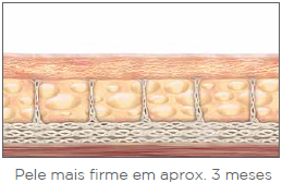 ULTHERAPY DR. EDUARDO BORNHAUSEN