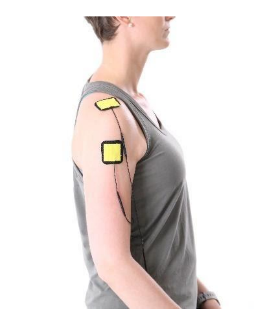 ipulse pad placement shoulder ipulse pad placement shoulder