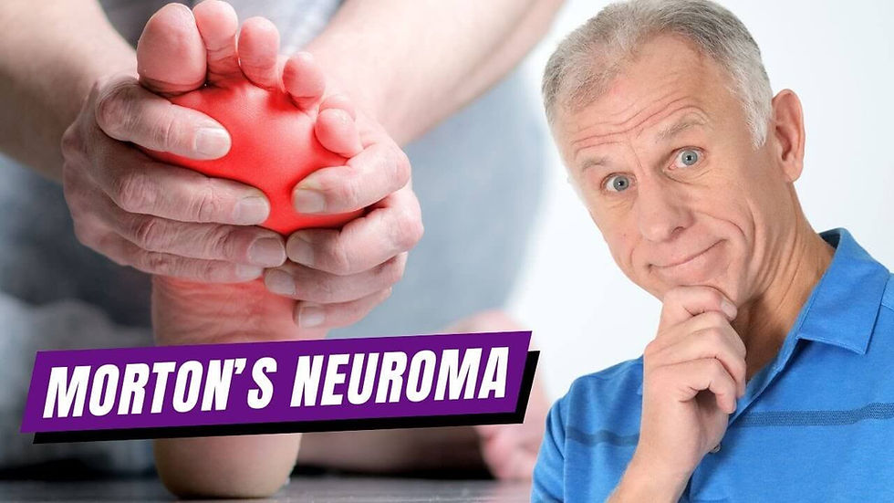 Morton's neuroma