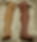(DVT)