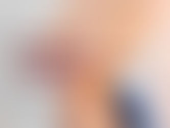 Quais os fatores de riscos da Trombose Venosa Profunda?