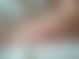 Identificando Sintomas da APLV em Bebês e Crianças: Guia Prático para Pais e Cuidadores