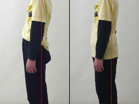 諦める前に試してほしい!首の痛みを改善し、快適な生活を送るための整体という選択肢