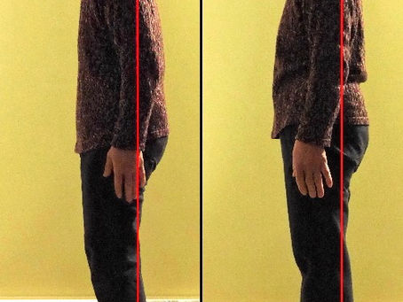 猫背矯正はカイロプラクティックで決まり!専門家が教える、正しい姿勢の作り方