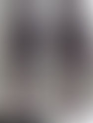 側弯症の悩みに光!カイロプラクティックで姿勢改善と痛みの緩和