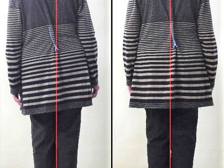 カイロプラクティックで美脚を目指す!X脚矯正のメリットとは?