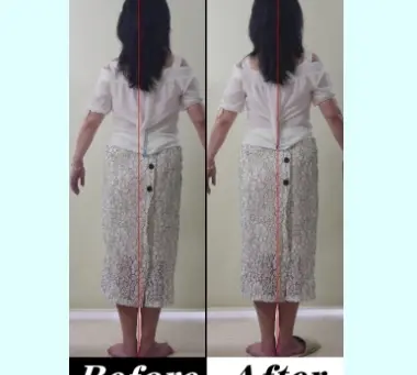 産後の骨盤はなぜゆがむ?その原因と整体による矯正の必要性