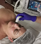RADIOFRECUENCIA FACIAL BOOSTERS VALENCIA.jpg