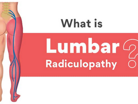 Lumbar Radiculopathy 