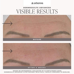 skincare before and after dermresults advanced arbonne results